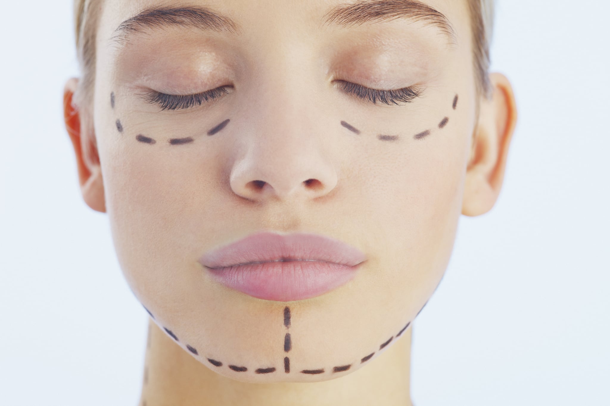 Chin Augmentation Surgery Chin Implant Surgery