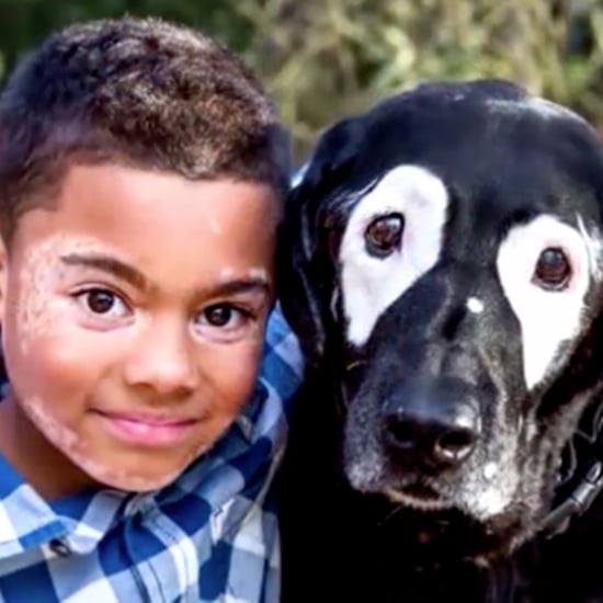 Boy With Vitiligo Meets Dog With Same Condition