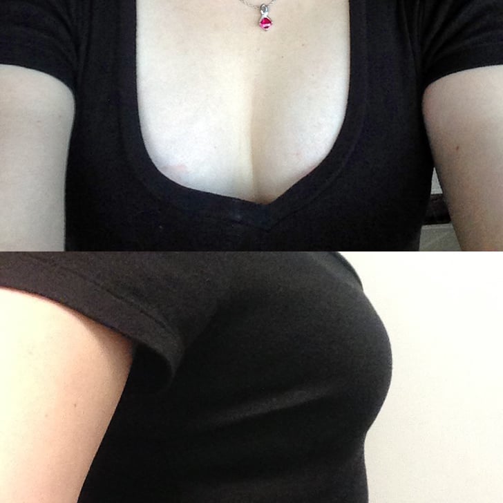 The Results These Images Showcase What My Breasts Looked Like After
