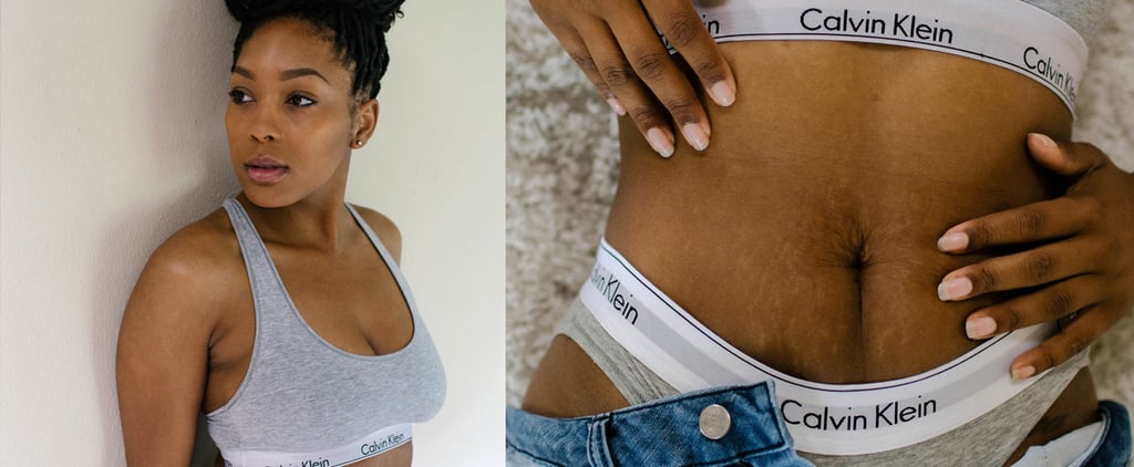 Mom Shows Off Stretch Marks in Calvin Klein Shoot | Video