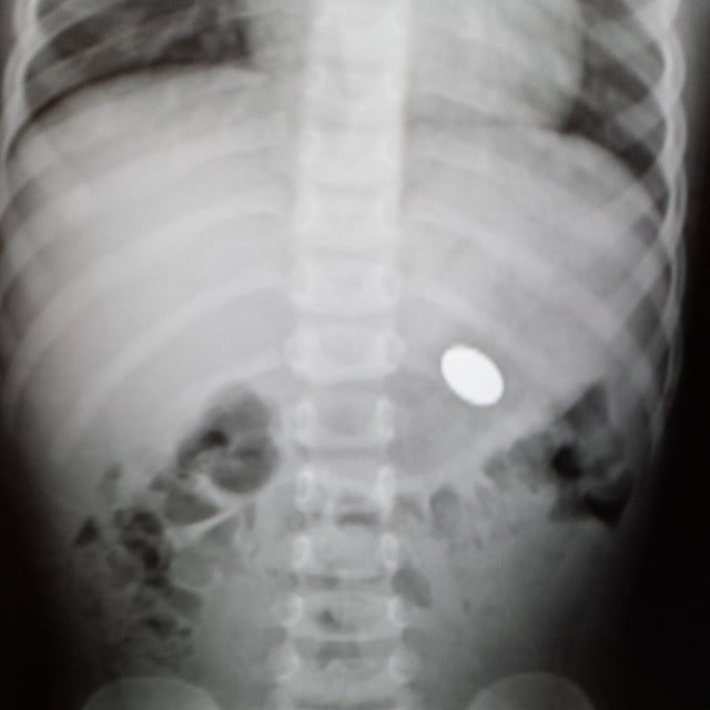 Did you check his insides?
