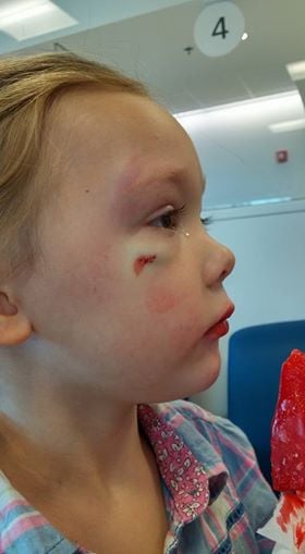 Why This Mom's Message to a Hospital Employee Has Gone Viral After Daughter Needs Stitches