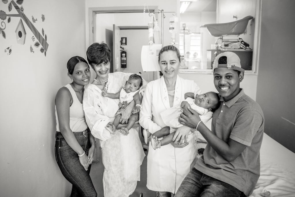 Conjoined Twins Are Separated and Photographed