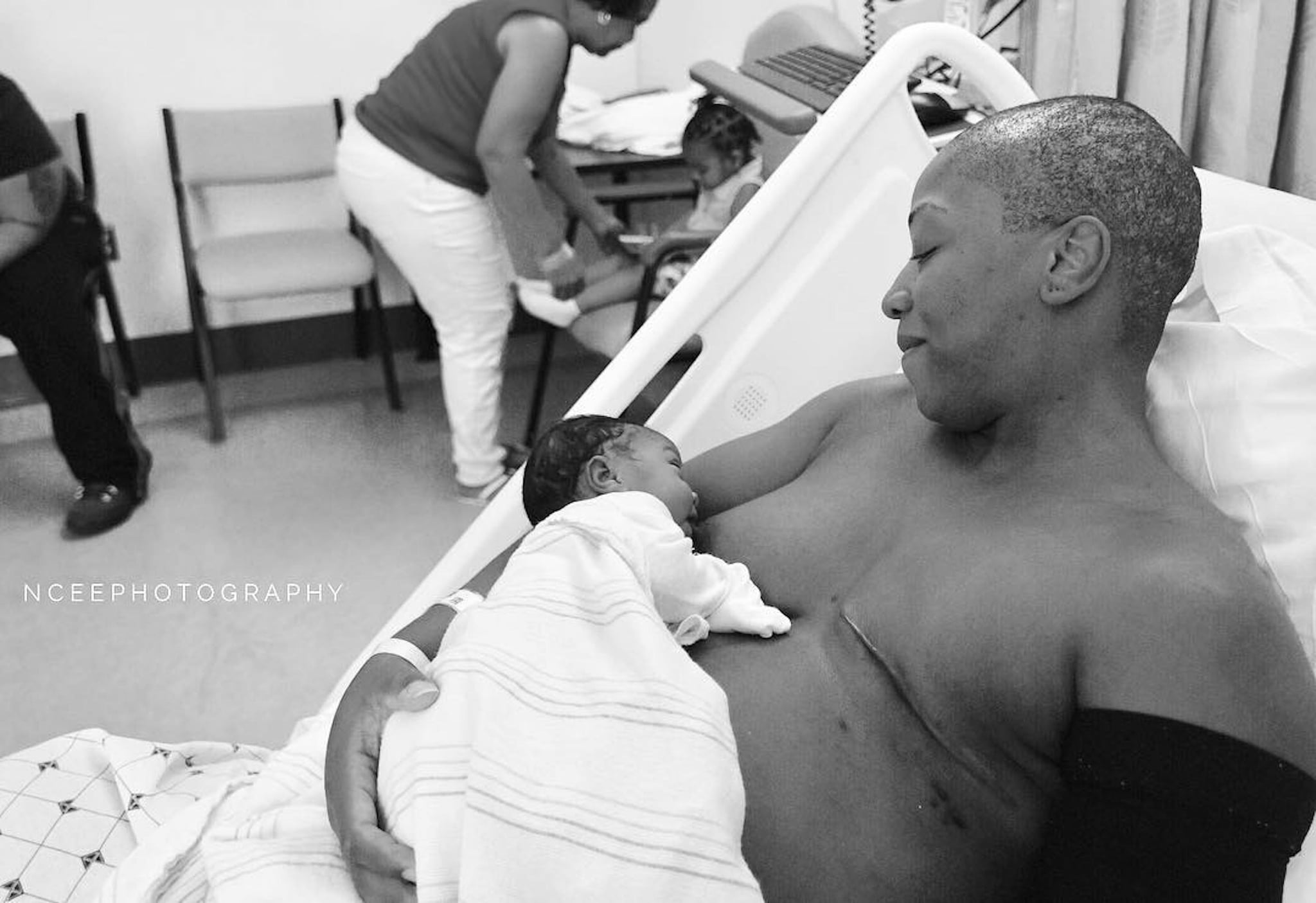 Mom Breastfeeding After Mastectomy Picture Popsugar Family