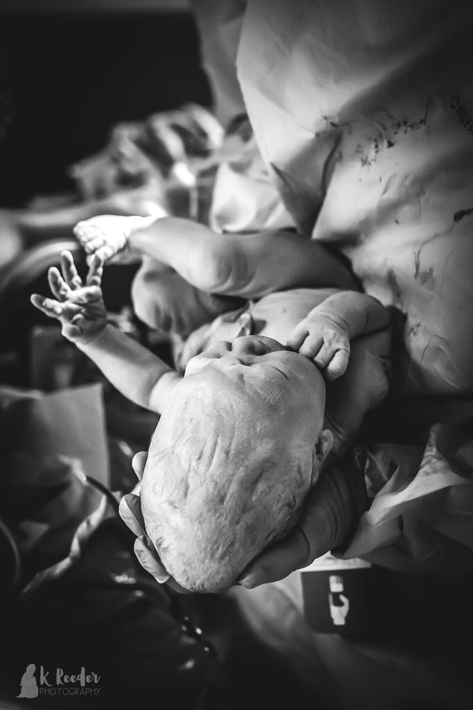 Newborn Head Molding During Birth