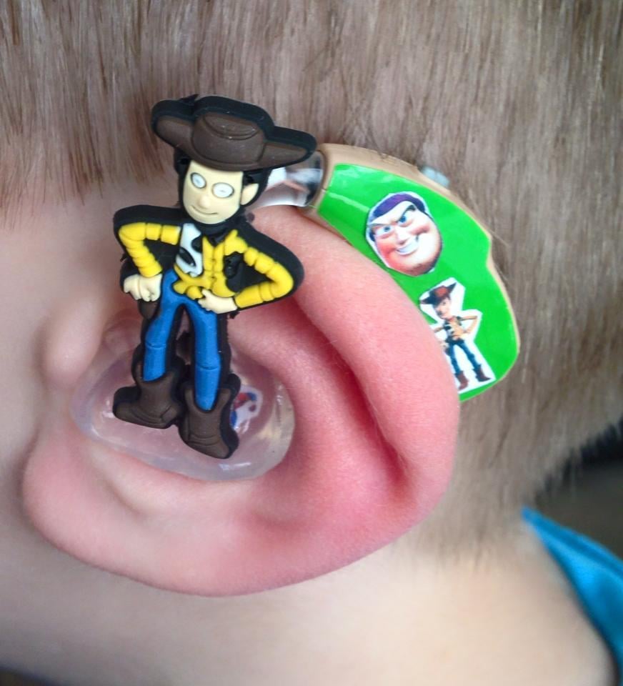 Mom Creates Superhero Hearing Aids For Son