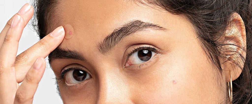 Best Hormonal Acne Spot Treatments | Editor Picks