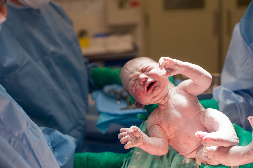 C-Section Birth Story Photo Shoot