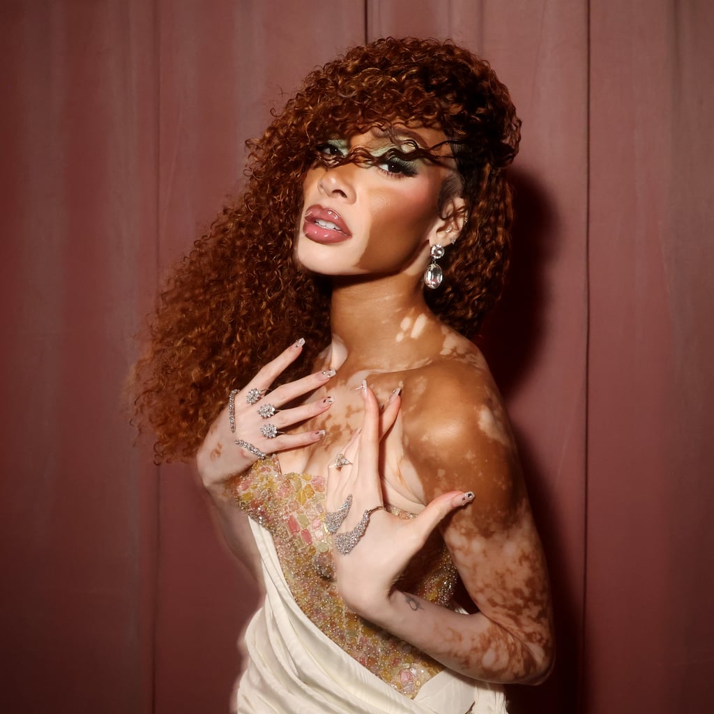 Winnie Harlow Has Some (Inner) Beauty Advice