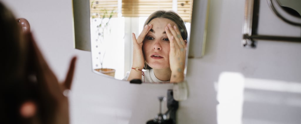 What It's Like Living With Cortisol Face