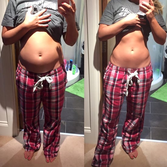 Blogger's Food Baby Disappears Overnight