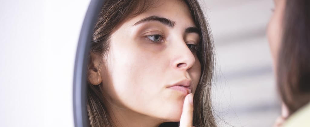 This Hack For Treating Cold Sores Has Saved Me So Much Money on Over-the-Counter Meds