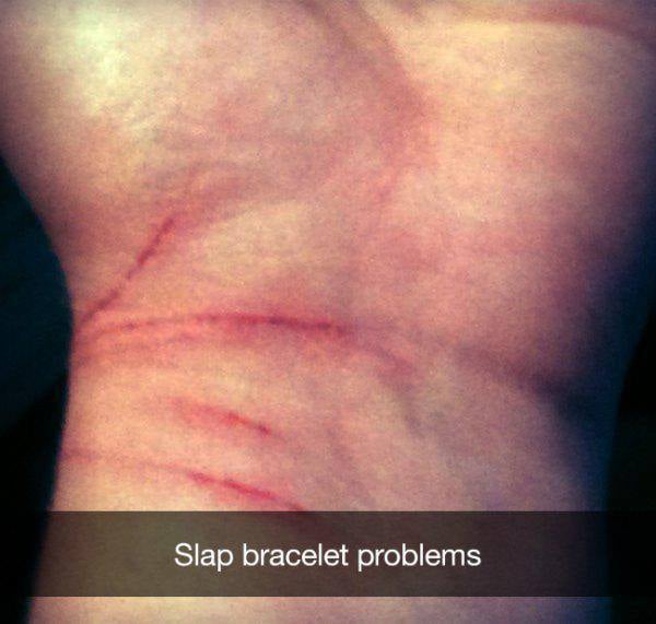 Ouch!