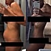 Living With Endometriosis Photos