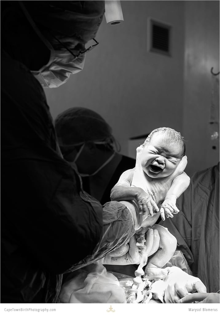Photos of C-Sections