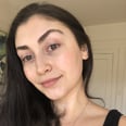 How I Got Rid of My Red Acne Marks With One Laser Treatment