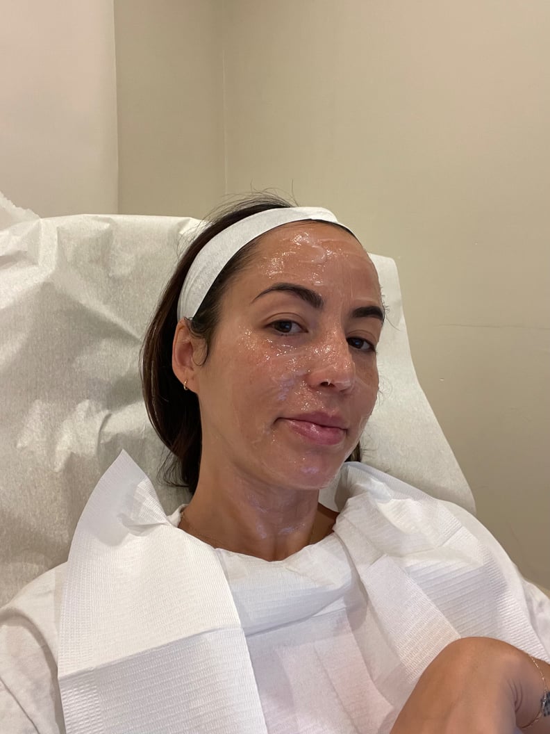 SkinPen Microneedling Editor Experiment