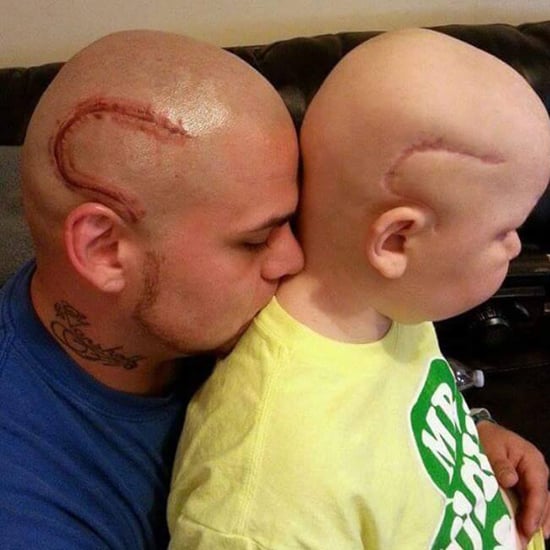 Dad Gets Tattoo on His Head of Son's Cancer Scar