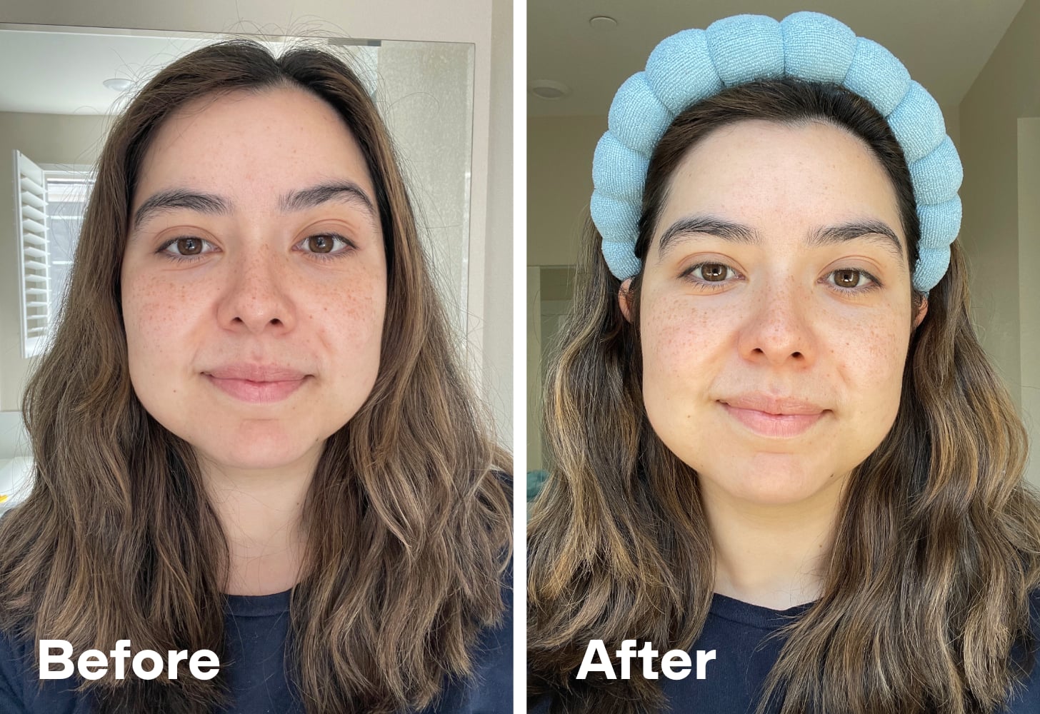 Before and After Using the Versed Skin Hydration Trio