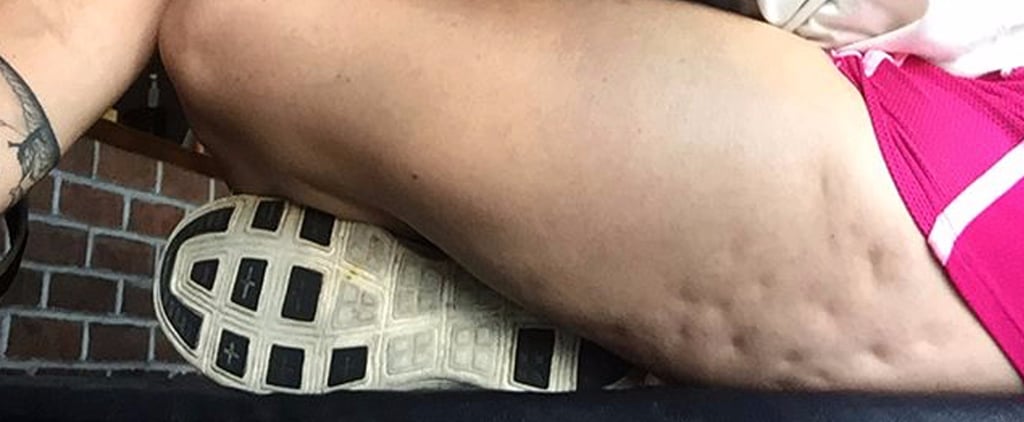 Fitness Trainer Shamed For Cellulite