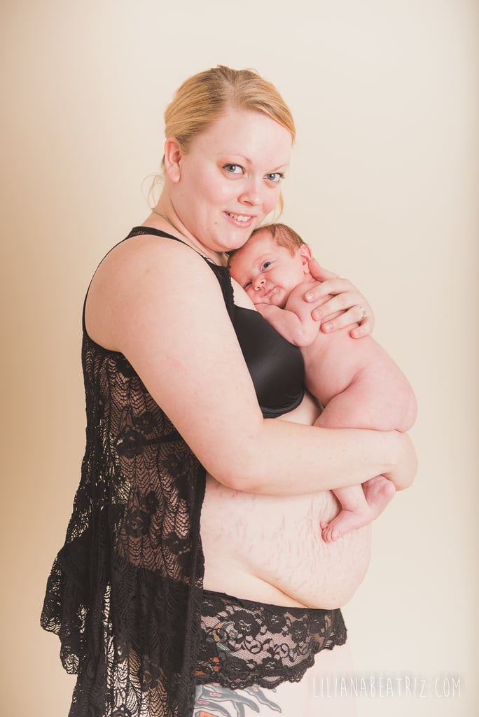 Unretouched Postpartum Bodies Photo Series