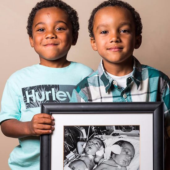 Then and Now Photos of Kids Who Were Born Premature