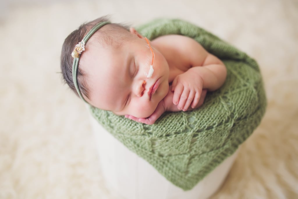 Newborn With Inoperable Tumor in Family Photos