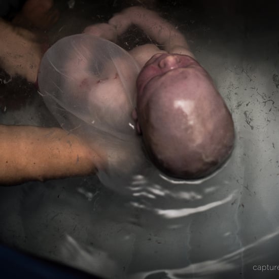 Baby Born En Caul and on Due Date