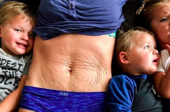 "Several months ago, I was given an opportunity from the TV show The Doctor's to have a noninvasive tummy tuck. They called me 'the perfect candidate.' To be honest, I have never once considered a tummy tuck, not because I don't support them, but because I do my best to love my body for what is now. I declined the offer twice and had to follow my heart." — Desiree Fortin