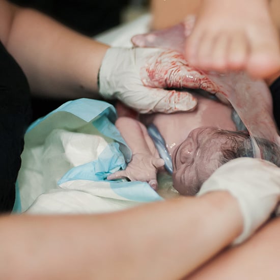 Photo of Baby Born En Caul in Amniotic Sac