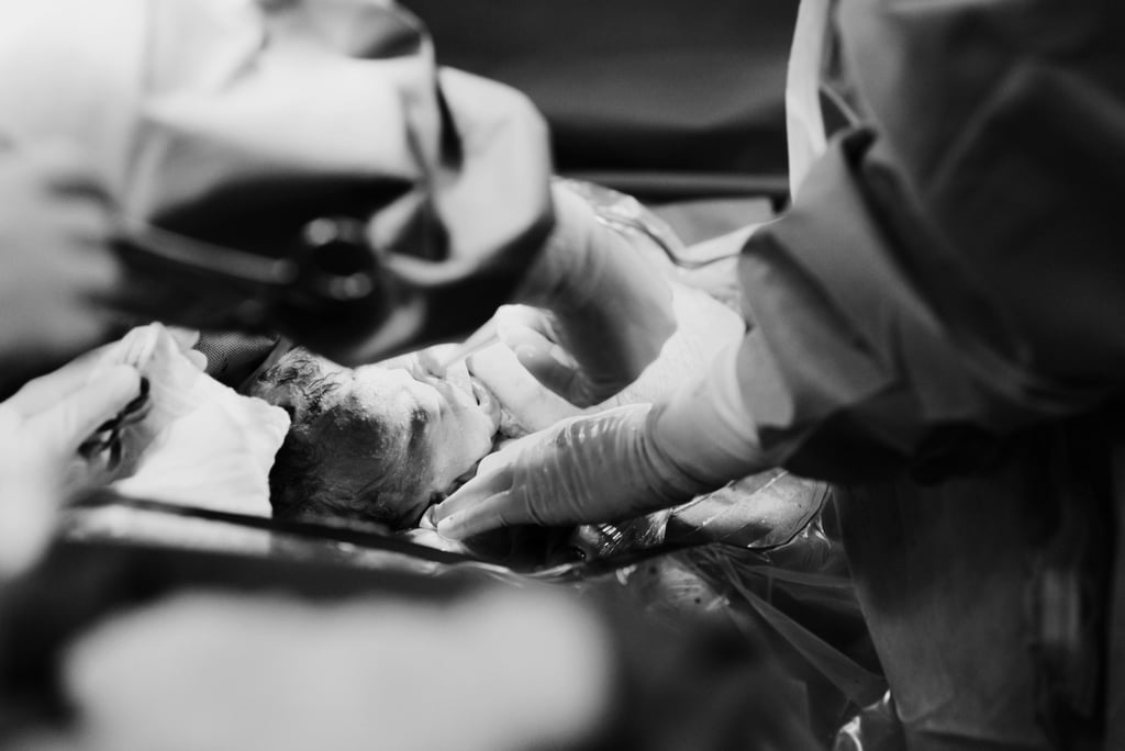 Dramatic C-Section Birth Photos