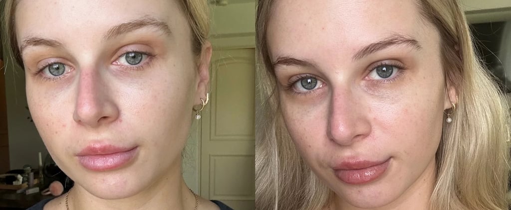Dr. Brandt Revitalizing Face Serum Review With Photos