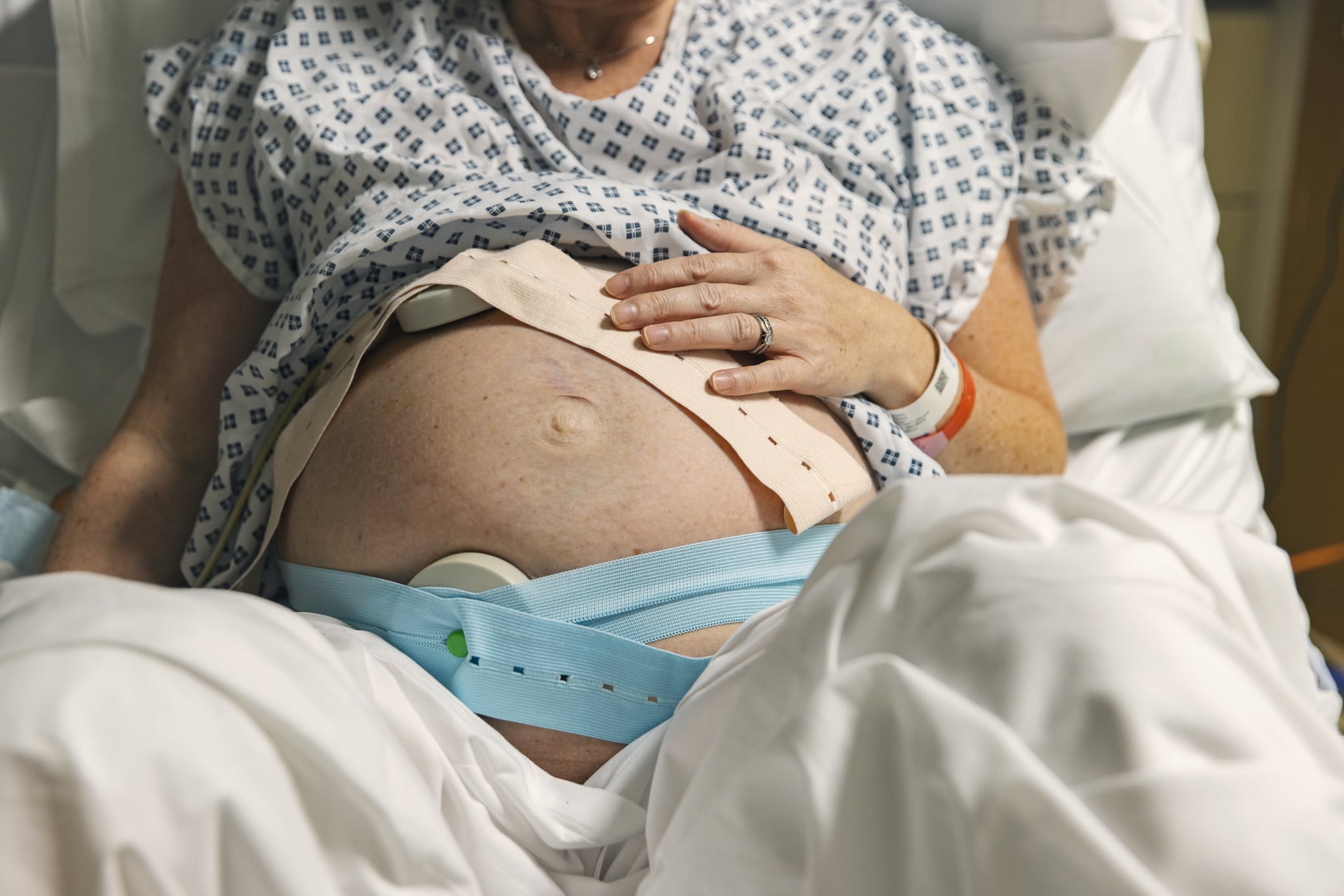 An unrecognisable mature pregnant woman lies on a hospital delivery bed as she has fetal monitoring. Cardiotocography is usually called a 'CTG' by medical staff. It can be used to monitor a baby's heart rate and a mother's contractions during pregnancy