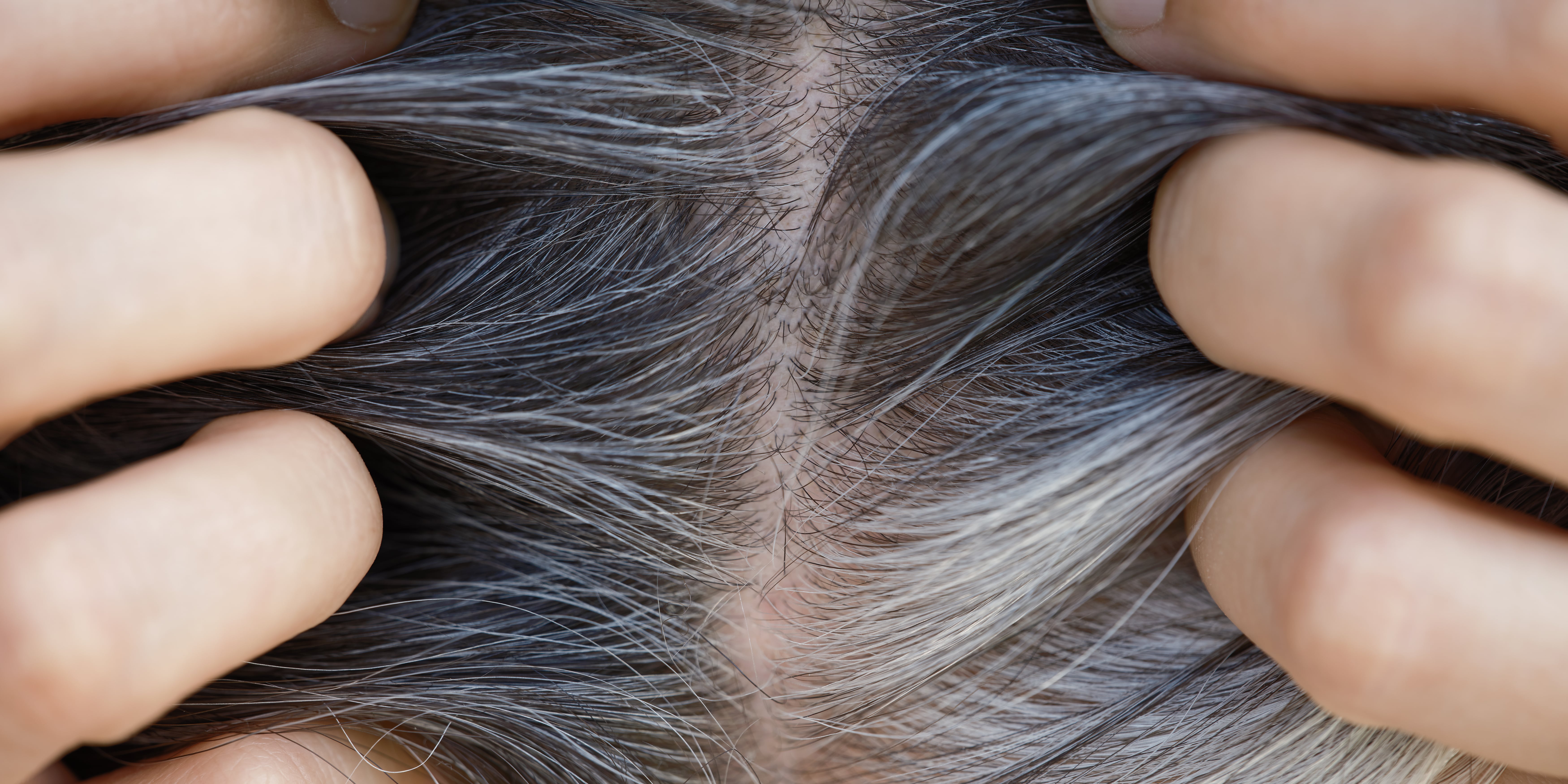 Does Stress Cause Gray Hair? Trichologists Explain - Vimarsana News