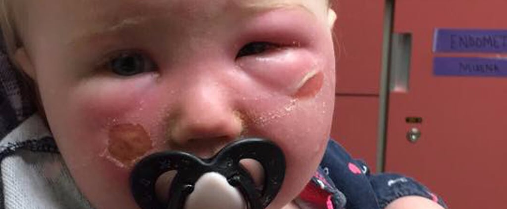 Should Kids Use Aerosol Sunscreens?