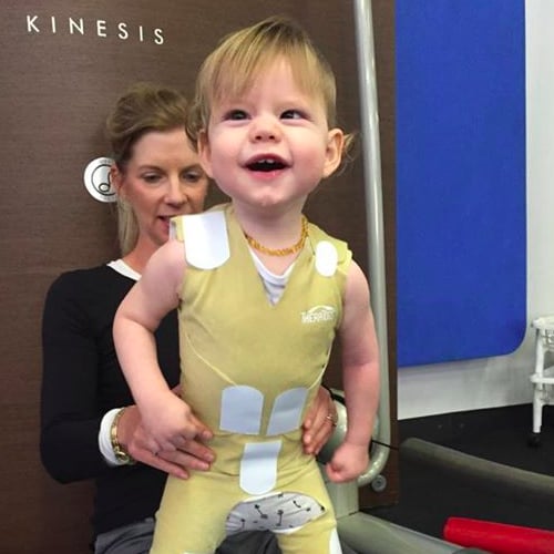 Baby Born With Smooth Egg Brain