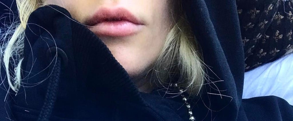 So Sweet! Beyoncé Sends Lady Gaga a Recovery Care Package