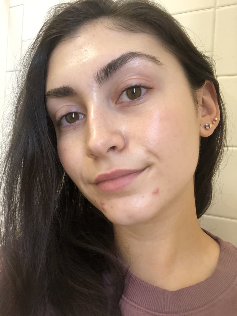 Now, let me preface this by saying I've tried a lot of acne treatments during my time as a beauty editor and beyond that. While some have mildly helped the issue, I'm usually left with a sense of discouragement because they take so long to "work" that I feel as if they really didn't do much at all. Before trying the Perricone MD Acne Relief Maximum Strength Spot Gel, I was under the impression that treating a pimple with anything less than a cortisone shot was a myth and that breakouts would simple pass when it was time and not a second before.