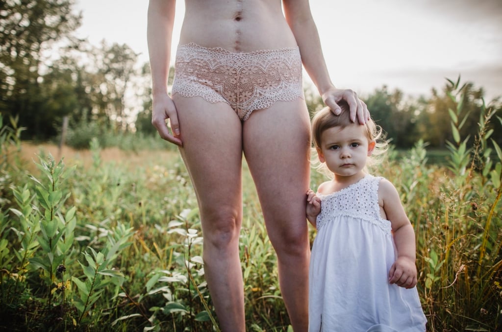 Photo Series of Postpartum Bodies