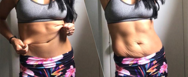 Powerlifter Uses Her Loose Skin to Empower Women Everywhere